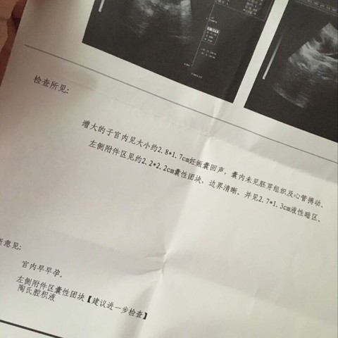 journal_insert_pic_443846092