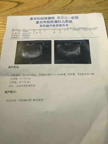 journal_insert_pic_445038644