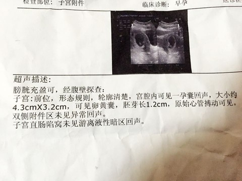 journal_insert_pic_446039369