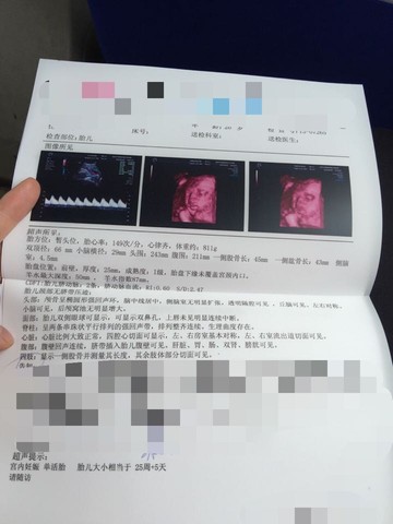 journal_insert_pic_446108392