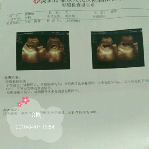 journal_insert_pic_447015891