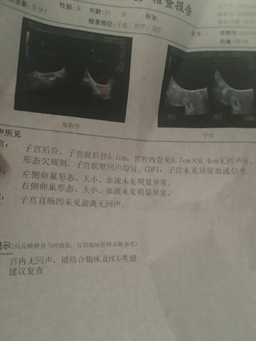 journal_insert_pic_448977782