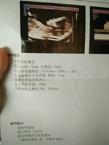 journal_insert_pic_452289617