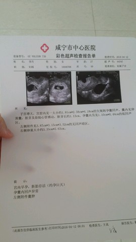 journal_insert_pic_455262292