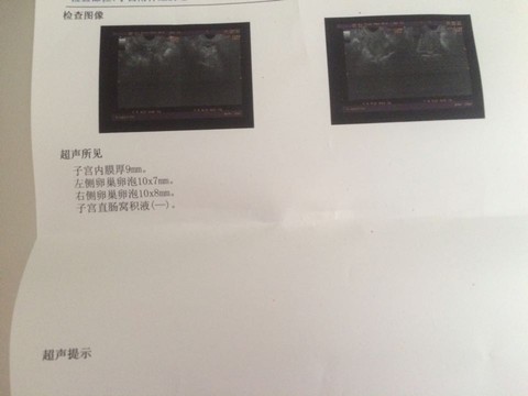 journal_insert_pic_455862077