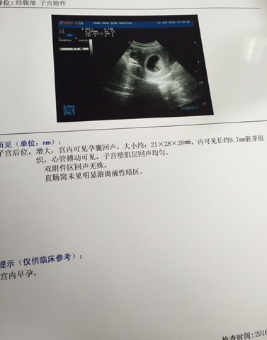 journal_insert_pic_456360319