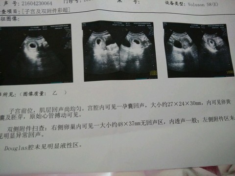 journal_insert_pic_459728418