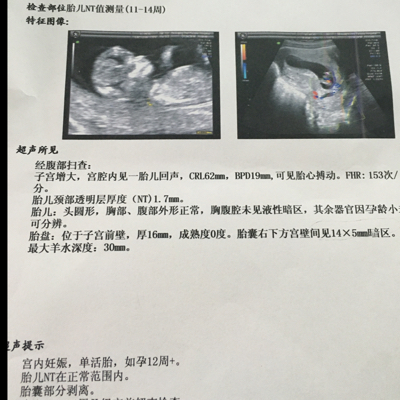 怀孕13周 没出血 医生叫住院保胎 怎么办 宝宝树