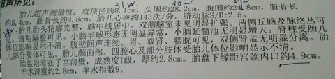 journal_insert_pic_461552273
