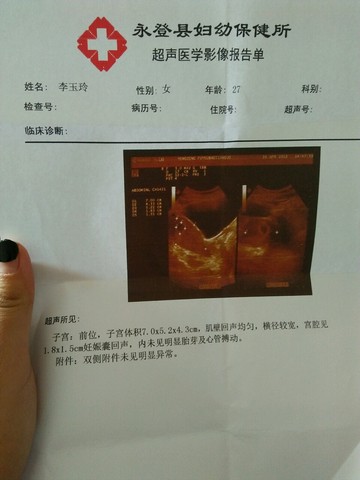 journal_insert_pic_462761100