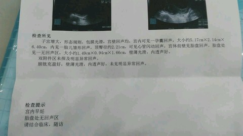 journal_insert_pic_463237064