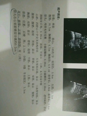 journal_insert_pic_463153988