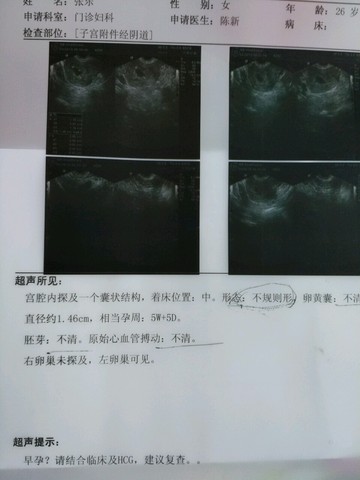 journal_insert_pic_464297067