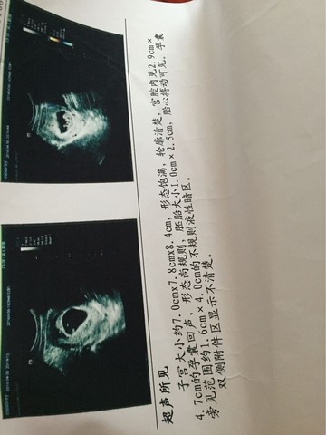 journal_insert_pic_466758829