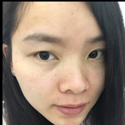 以前有点斑,怀孕后什麼护肤品都没用了,脸乾燥粗糙没有水分,斑就越来