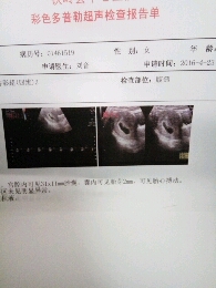 journal_insert_pic_468212524