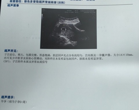 journal_insert_pic_468209435