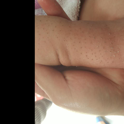 最近宝宝身上长了倒毛,黑粒粒的,用奶在身上搓揉全部都出来了,这几天