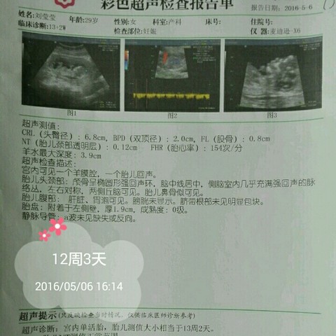 journal_insert_pic_471147458