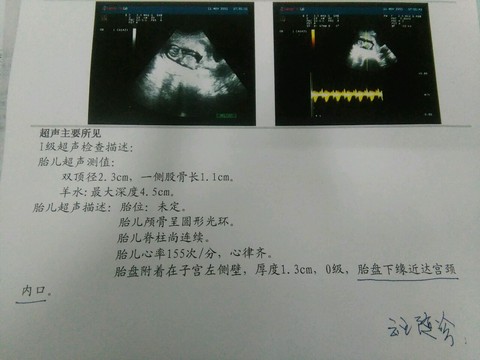 journal_insert_pic_471244898