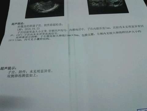 journal_insert_pic_472131554