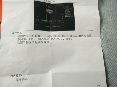 journal_insert_pic_471874515
