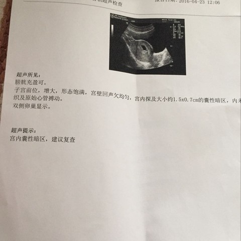 journal_insert_pic_471790596