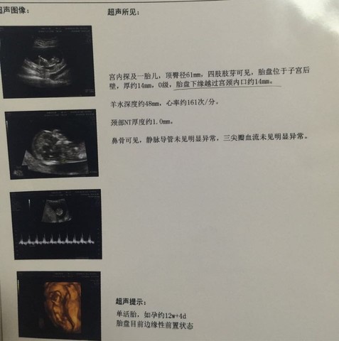 journal_insert_pic_471835674