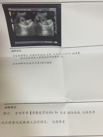journal_insert_pic_472622657