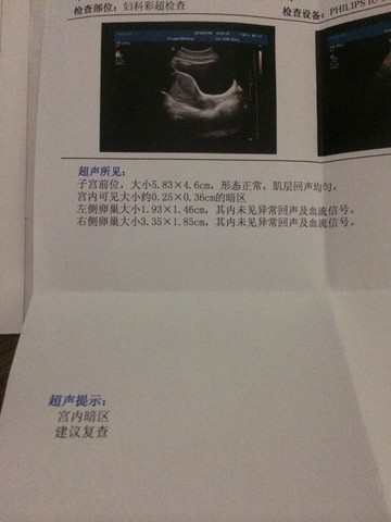 journal_insert_pic_473617864