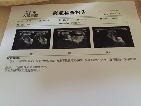 journal_insert_pic_476643761