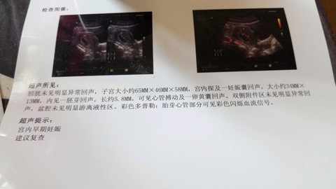 journal_insert_pic_476408980