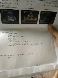 journal_insert_pic_477951999