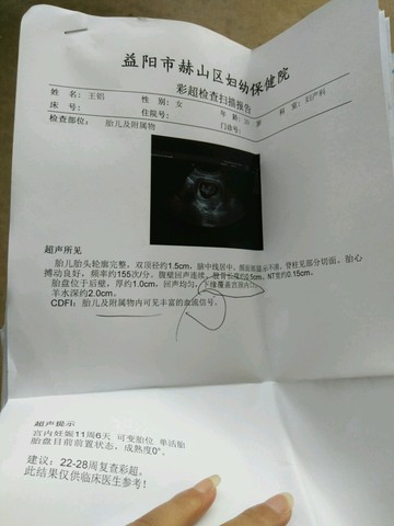 journal_insert_pic_478105944