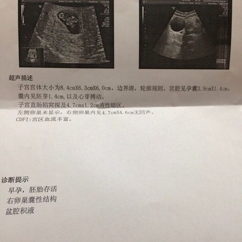 journal_insert_pic_478733353