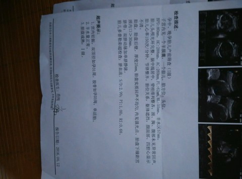 journal_insert_pic_479065280