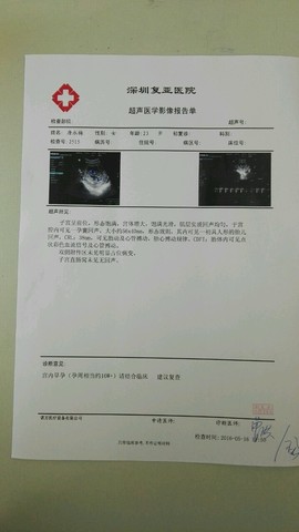 journal_insert_pic_480062265