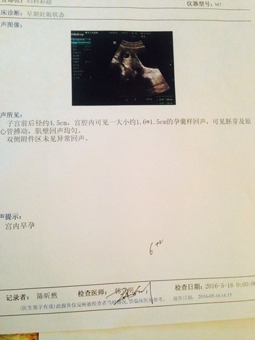 journal_insert_pic_481209046