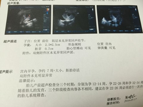journal_insert_pic_480639530
