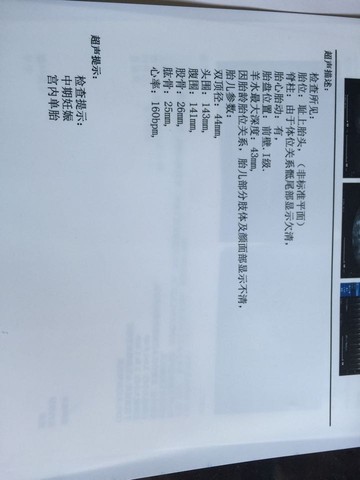 journal_insert_pic_481108989
