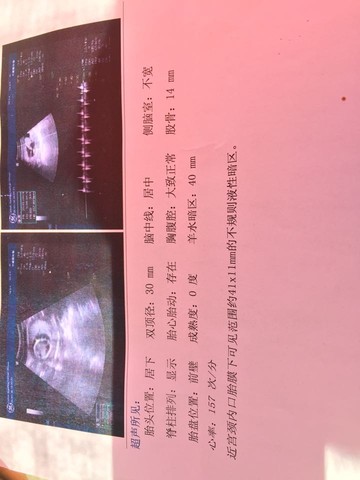 journal_insert_pic_481800657