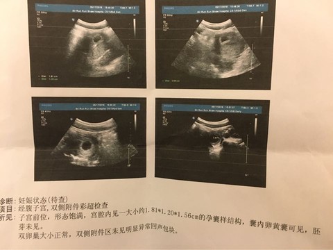 journal_insert_pic_481991340