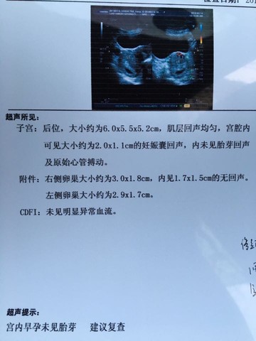 journal_insert_pic_482983613