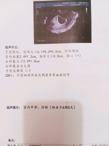 journal_insert_pic_482726122