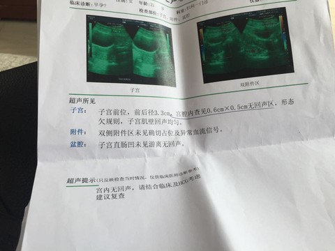 journal_insert_pic_483774012