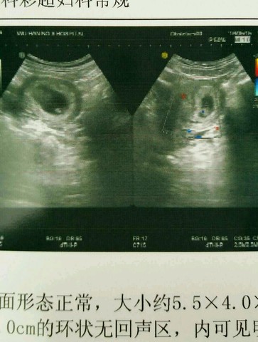 journal_insert_pic_484565585