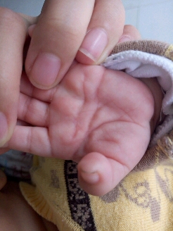 新生儿手纹断掌图片图片