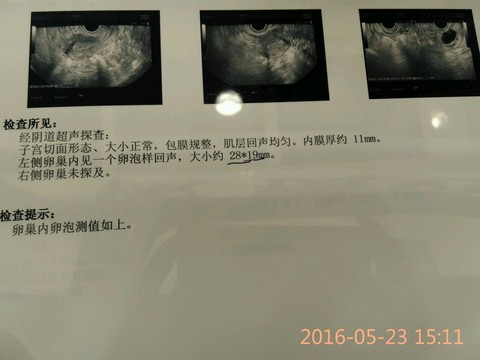journal_insert_pic_486761638