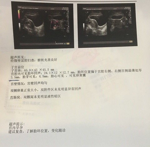 journal_insert_pic_489256820