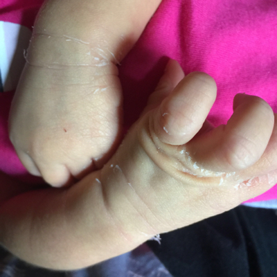 婴儿期0-1岁 推荐回答                      现在宝宝小,身上的皮还